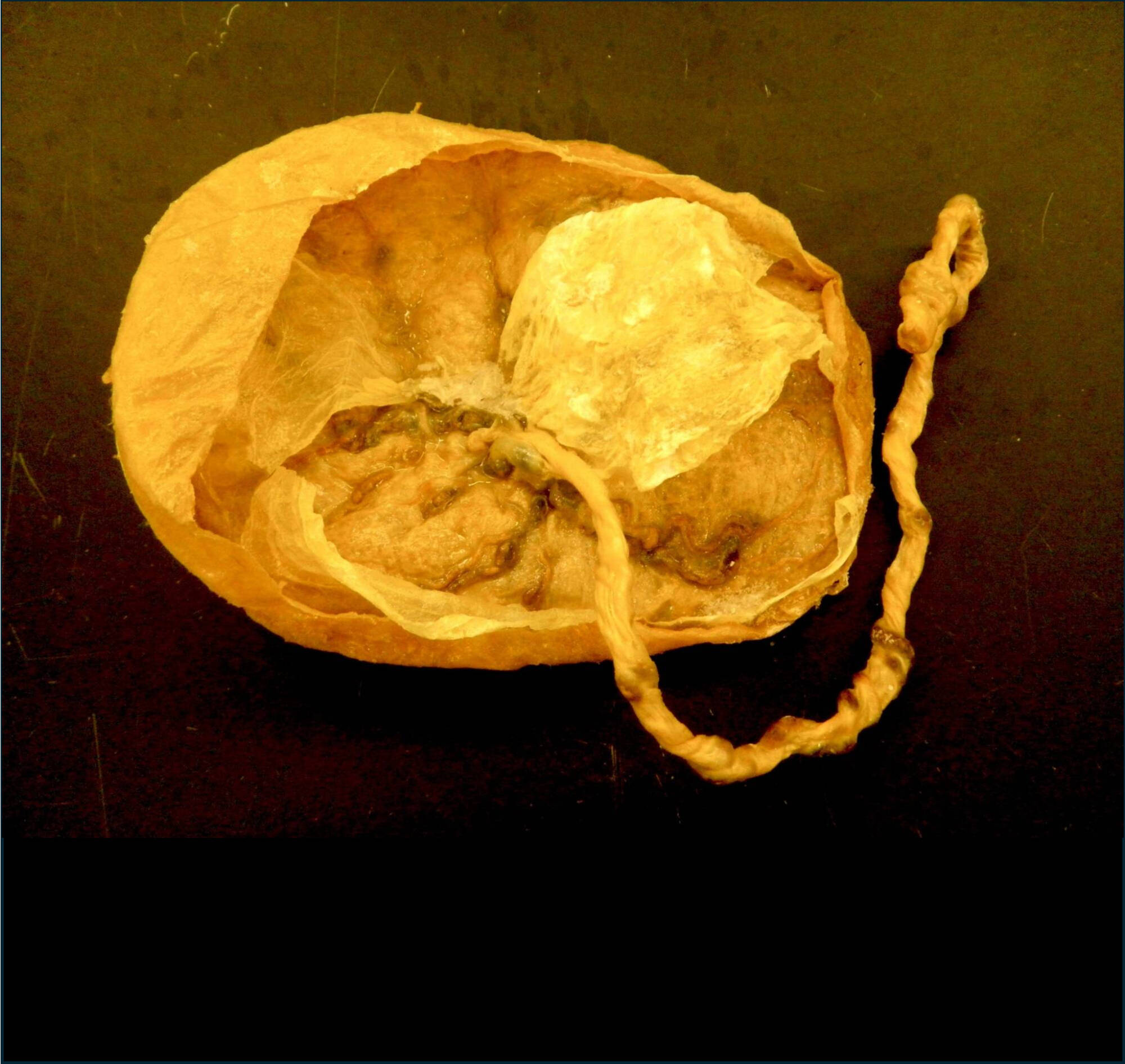 Human placenta & umbilical cord